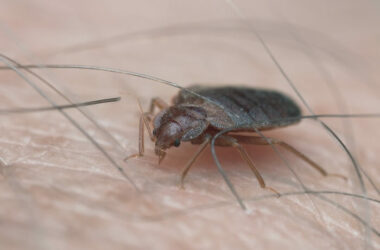 A bed bug in in hair