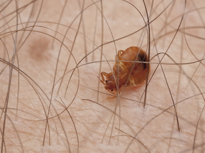 One bed bug stumbling through hair