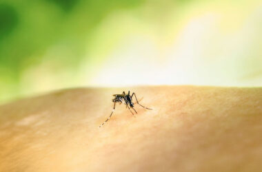 Bed bug bites vs. mosquito bites