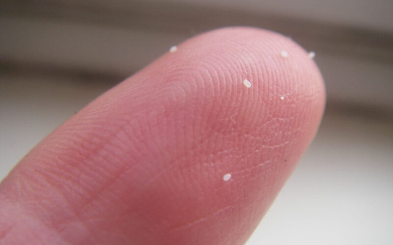 What do flea eggs look like