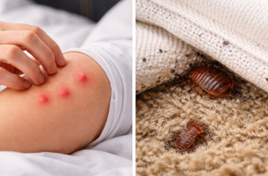 Why Do Bed Bugs Bite at Night and Not During the Day?
