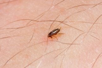 Can Dog Fleas Live in Human Hair​?