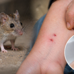 Do House Mice Bite Humans and What to Do If Bitten 