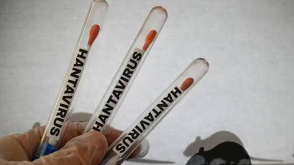 How Hantavirus Spreads And How To Prevent It? 5 How Is Hantavirus Treated?