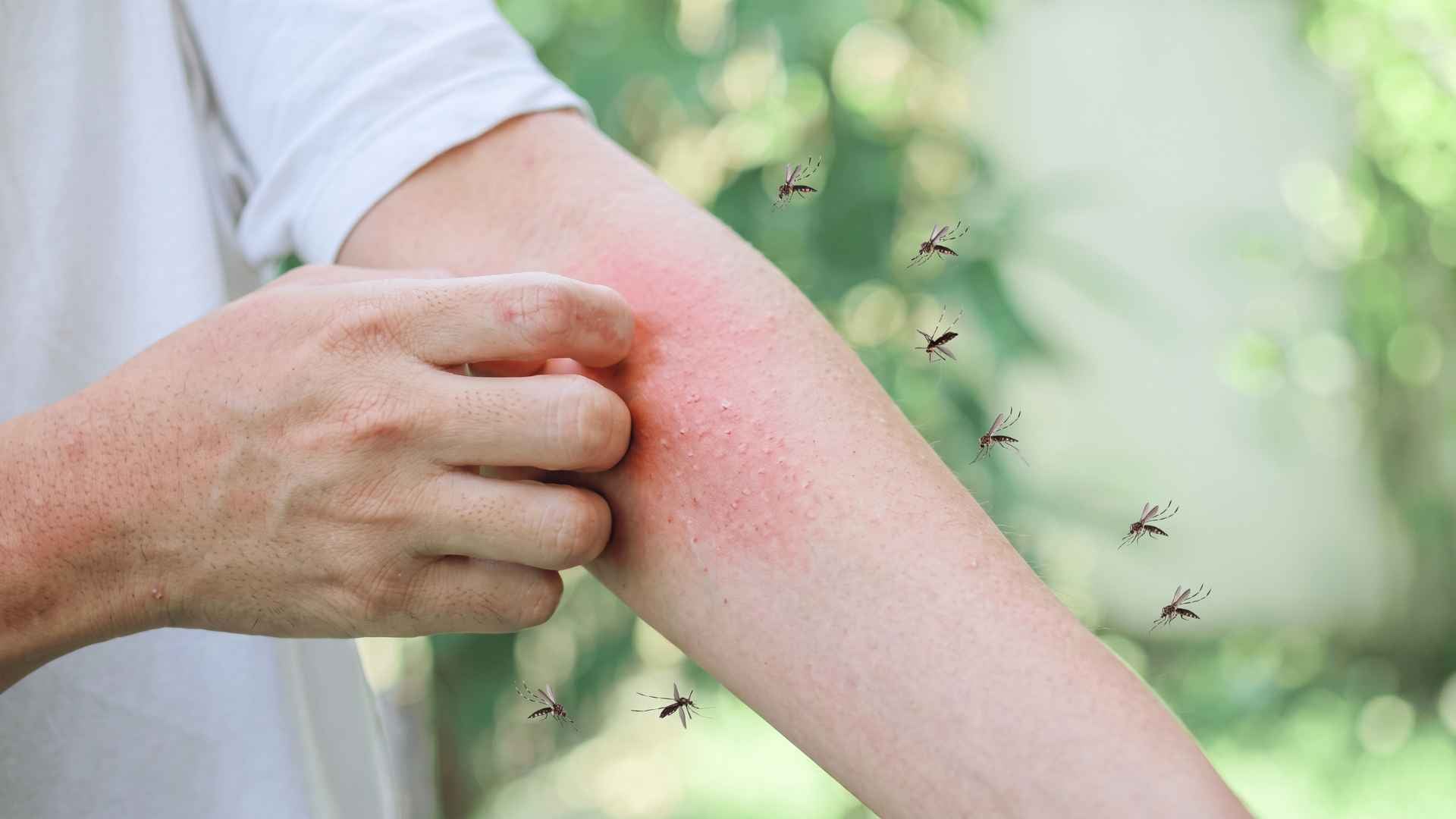 Do Mosquitoes Come Out in Rain? What You Should Know 4 Can Mosquitoes Bite You Right After Rain?